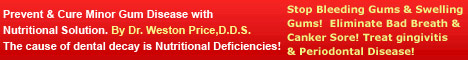 Minor Gum Disease